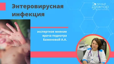 Энтеровирусная инфекция | Сургутская городская клиническая поликлиника № 4