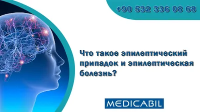 Дежавю может быть эпилептическим приступом. Врач о проявлениях и причинах  болезни - Здоровье