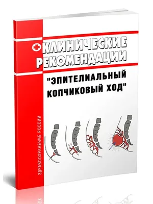 Удаление эпителиального копчикового хода. Скальпель-нитки или SiLaC?  Альтернативная медицинская клиника