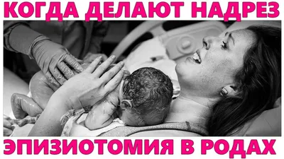 Ro_doula - Эпизиотомия vs. Разрывы промежности ⠀... | Facebook