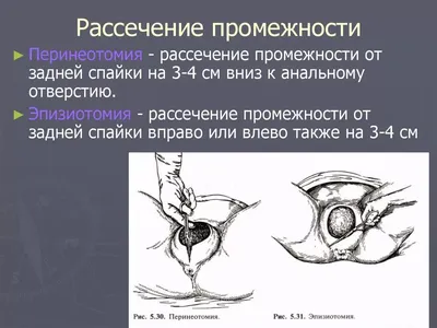 ПЕРИНЕАЛЬНАЯ ТРАВМА В АКУШЕРСКОМ СТАЦИОНАРЕ ТРЕТЬЕГО УРОВНЯ – тема научной  статьи по клинической медицине читайте бесплатно текст  научно-исследовательской работы в электронной библиотеке КиберЛенинка