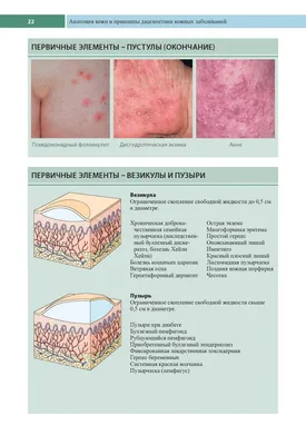 Иллюстрация 9 из 25 для Клиническая дерматология. Аллергические дерматозы -  Томас Хэбиф | Лабиринт - книги. Источник: Лабиринт