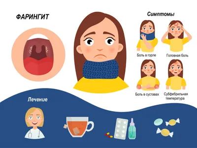 Что такое фарингит. Вирусный и бактериальный фарингит