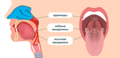 Что это за болезнь? | Пикабу