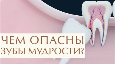 Остеопластические операции: факторы успеха. Часть III. — IMPLANT-IN.COM —  дентальная имплантация. естественно.