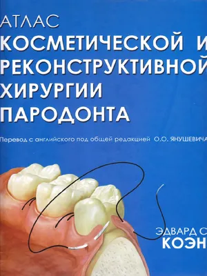 Почему 4-й день болит десна после удаления зуба? — Москва