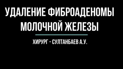 Филлоидная (листовидная) фиброаденома молочной железы - история лечения в  Ильинской больнице.