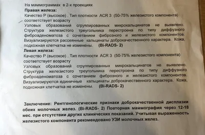 Удаление фиброаденомы молочной железы в клинике Уфы: фото, отзывы, стоимость