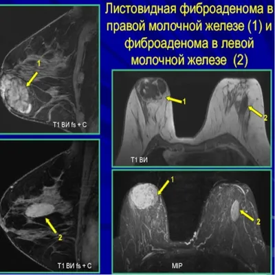 Медицинские статьи на сайте компании Эндомедис