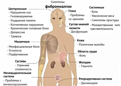 Фибромиалгия: причины, симптомы и лечение в Москве в ФНКЦ ФМБА