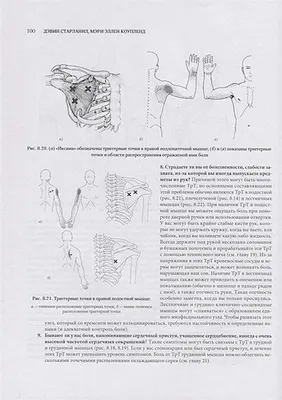 Фибромиалгия – о симптомах и лечении заболевания рассказала врач-ревматолог  - Апостроф