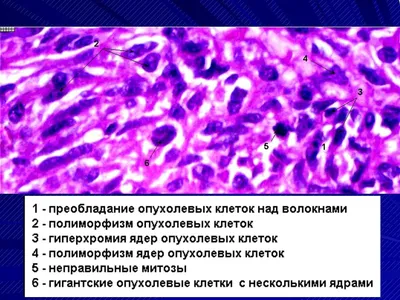 Сirculotest ONCO - Компания ЦИРКУЛОТЕСТ представляет панель NTRK-fusion  genes -20 генов , выполненную методом жидкостной биопсии CIRCULOGENE.  Данный метод включает в себя: - качественную экстракцию соматической РНК  (онко-РНК) из 4 мл венозной