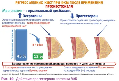 Фиброзно-кистозная мастопатия | Доктор Гульнара Мазитова | Дзен