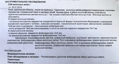 Гомеопатия Bionorica Мастодинон капли - «Вам врач поставил диагноз -  фиброзно-кистозная мастопатия? У Вас болит грудь, появляется чувство  тяжести, уплотнения, больно дотронуться до нее? Этот препарат Вам точно  поможет!» | отзывы