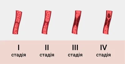 фото человека с кожей на руках, флебит на руке фото, человек, руки фон  картинки и Фото для бесплатной загрузки