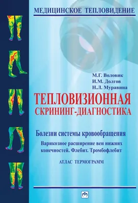 Диагностика и лечение Флебита нижних конечностей в Киеве и Харькове -  «Институт Вен» лечение варикоза в Киеве и Харькове