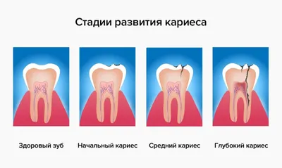 Флюс на десне у ребенка - стоимость услуги Детская стоматология в Киеве,  Флюс на десне у ребенка - цена в стоматологии lipinskii.com.ua