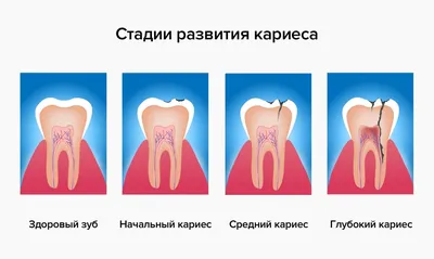 Флюс (периостит челюсти) — что это такое, причины возникновения,  диагностика и методы лечения