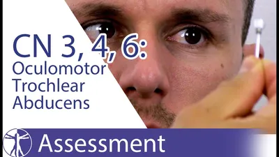 Cranial Nerves 3, 4, 6 | Oculomotor, Trochlear, Abducens Nerve Assessement  for Physiotherapists - YouTube