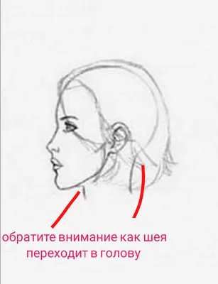 Случай 32. Коррекция асимметричной Дисгнатии III класса, устранение  аномалии окклюзии III класса, коррекция формы носа.