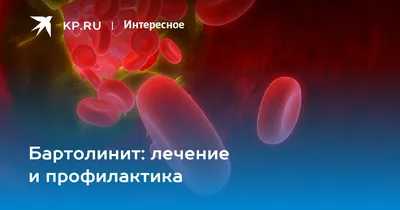 Бартолинит: лечение и профилактика - KP.RU