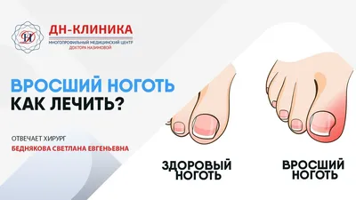 Холецистит: симптомы, причины, лечение | Клиника \"Добрый прогноз\"