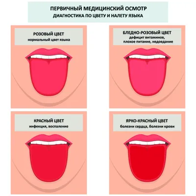 Привкус во рту: причины, диагностика и лечение