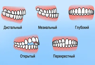 Ecthyma | Обзор инфекционный Ecthyma во рту козла Ветеринарная медицина  Болезнями животных Ветеринар овец- корова Стоковое Фото - изображение  насчитывающей ангстрома, мило: 199362138