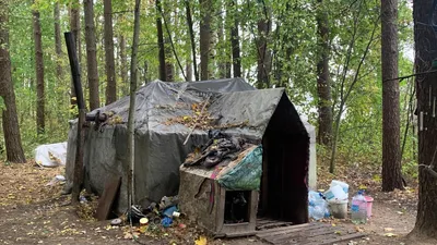 Индийский бомж со страшной рукой (5 фото)