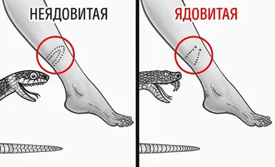 В Ярославской области активизировались опасные змеи, гадюки и ужи, фото  гадов — инструкция, как отличить ядовитую змею от неядовитой - 3 мая 2022 -  76.ru