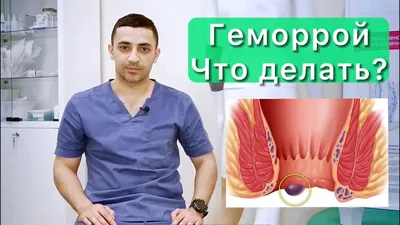 Наружный (внешний) геморрой: симптомы, как выглядит, что делать, лечение,  профилактика