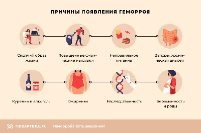 Наружный геморрой - лечение внешних геморроидальных узлов