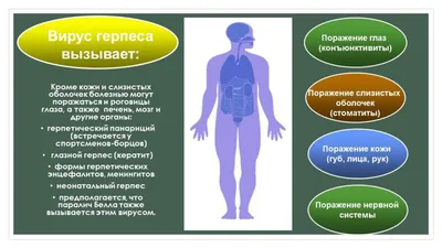 Лечение генитальной инфекции для мужчин лечение трав жидкая черепица  лечение вспышки против простого лекарственного средства от герпеса лечение  вульвы для женщин | AliExpress