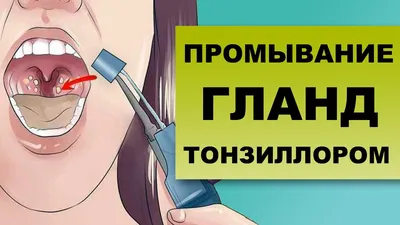 9 неэффективных методов лечения в отоларингологии. Взгляд со стороны  доказательной медицины