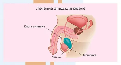 Удаление кисты зуба - стоимость услуги Резекция верхушки корня зуба в  Киеве, Удаление кисты зуба - цена в стоматологии lipinskii.com.ua