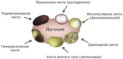 Гигантскую кисту с паразитами вырезали у женщины в Алматы – шокирующее фото  - 03.11.2021, Sputnik Казахстан