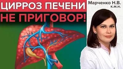 Дифференциальная диагностика циррозов печени. Печеночная недостаточность -  презентация онлайн