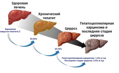 Звездочки\" на коже предупреждают вас о крайне опасном заболевании |  12.10.2022, ИноСМИ