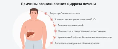 Цирроз печени: причины, признаки, симптомы и лечение