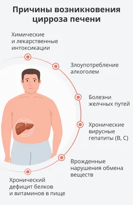 В России сильно выросла заболеваемость циррозом, выяснили ученые - РИА  Новости, 03.03.2020