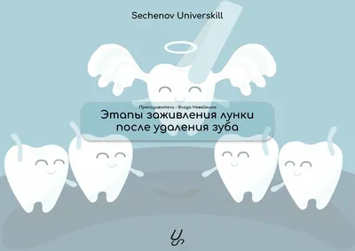 Для пациентов. Поговорим об удалении зубов.