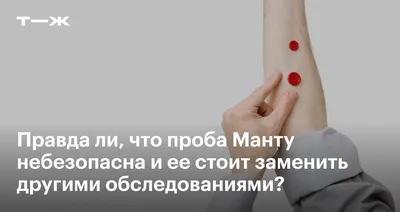 Ответы Mail.ru: Диаскинтест, манту, проба диаскин