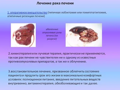 Назван способ определить наличие проблем с печенью по цвету ладоней:  Здоровье: Наука и техника: Lenta.ru