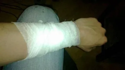 Мужчина порезал себе вены во время задержания полицией - Киев