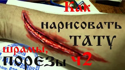 Сильное кровотечение - Бытовые ЧС - МЧС России