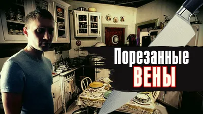 Выступают вены на ногах: причины, лечение и профилактика - phlebo1.ru