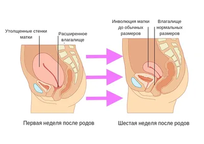 Эпизиотомия при родах - «Ну очень подробно как я лечила швы после  осложнённых родов. Описание по неделям. ОБНОВЛЕНО спустя 8/9месяцев. Итог:  дисплазия 1 степени. Есть фото» | отзывы