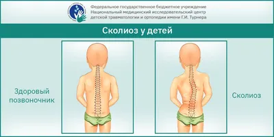 Номера позвонков в позвоночнике человека рисунок с подписями