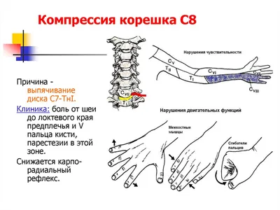 МРТ грудного отдела - Отделение КТ и МРТ НИИ СП им. Н.В. Склифосовского