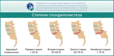 Форум по пауэрлифтингу в России и мире powerlifting, нормативы по  пауэрлифтингу всех федераций WPC, IPA, IPF, чемпионат, тренировки,  соревнования, федерация, экипировка, фитнес, бодибилдинг, гиревой спорт,  силовой экстрим, упражнения, спортивное ...